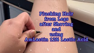 Plucking Hair from Legs after Shaving and using AmLactin 12% Lactic Acid  | Curly Cami Channel