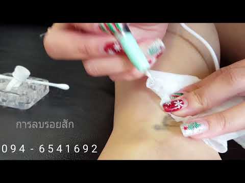 สมาชิกดำเนินการ SPb เพิ่ม ซื้อหญิงเชื้อโรค Penza