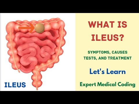 What is Ileus? | Symptoms | Causes | Complications | Tests | Treatment |Precautions |Medical Coding|