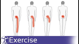 Direction Specific Exercises for Low Back Pain | Directional Preference