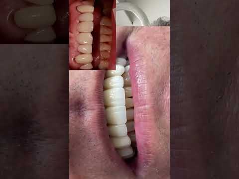 video ShQV3iKcKkA