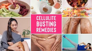 How To Get Rid Of Cellulite Naturally | Home Remedies For Cellulite On Thighs, Stomach & Arms