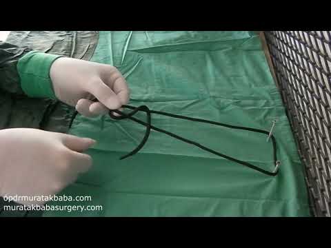 Weston Sliding Knot(Laparoscopic Extracorporeal Knots) by MURAT AKBABA,MD