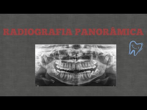 RADIOGRAFIA PANORÂMICA - PASSO A PASSO