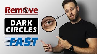 BEST ways to get rid of DARK CIRCLES under your EYES | THE TRUTH