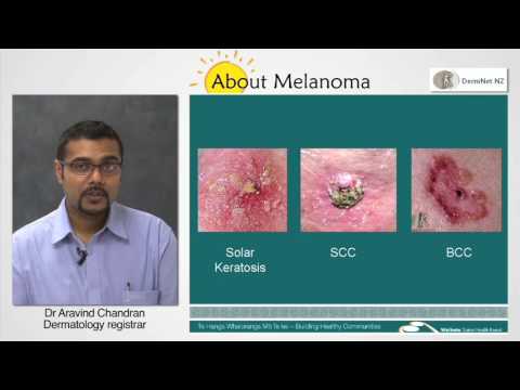 Melanoma Risk Factors
