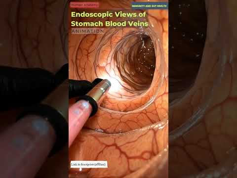Endoscopic Views of Stomach Blood Veins Animation | Immunity and Gut Health | Human Anatomy | 02