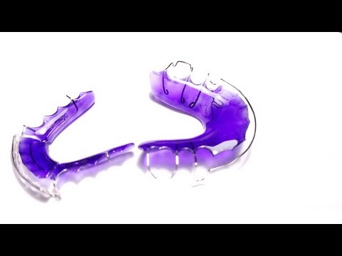 Live: Wire Wednesday #5 - Springs, Spring and More Springs!