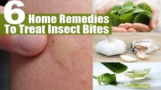 How To Get Rid Of A Mosquito Bite With Home Remedies.