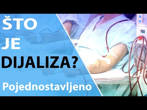 Dijaliza bubrega Hemodijaliza vs Peritonealna dijaliza, Dr#58