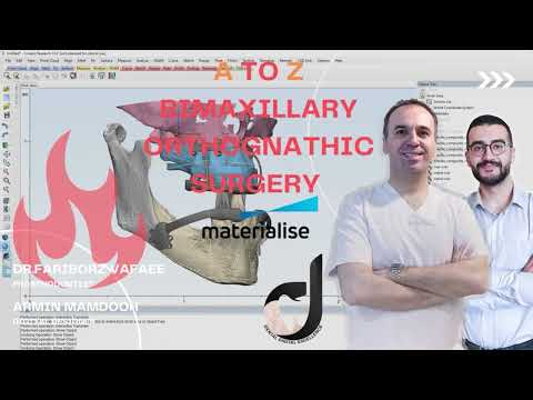 A To Z bimaxillary orthognathic surgery with materialise🔥