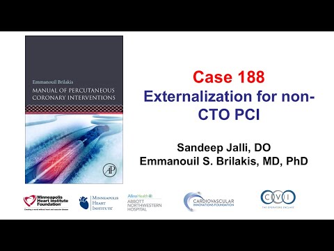 Case 188: Manual of PCI - Externalization for non-CTO PCI