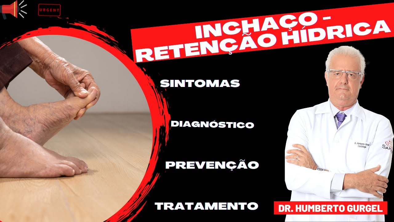 Humberto De Mendonca Gurgel-31