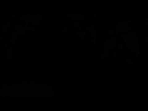 Roland TD-17KVX + Getgooddrums P4 Kit