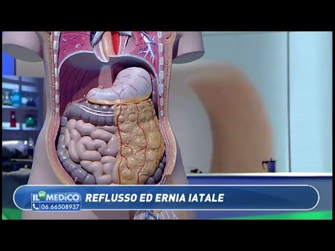 Il Mio Medico - Reflusso ed ernia iatale