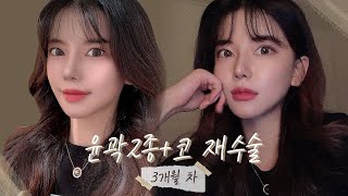 매일 동안 메이드영성형외과 – 미디어 매일 동안 메이드영성형외과 – 미디어