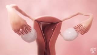 Female fertility animation video