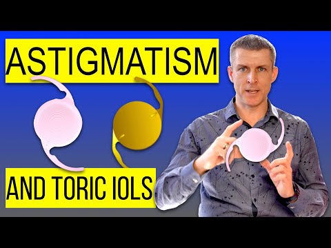 Astigmatism and cataract surgery : proper cataract lens choice