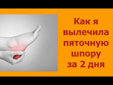 Болит нога в бедре остеохондроз Боль в нижней части спины слева отдающая в ногу