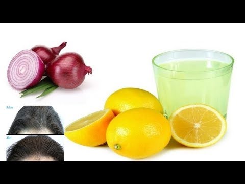 download lagu mp3 mp4 Onion And Lemon Mixture For Hair, download lagu Onion And Lemon Mixture For Hair gratis, unduh video klip Onion And Lemon Mixture For Hair