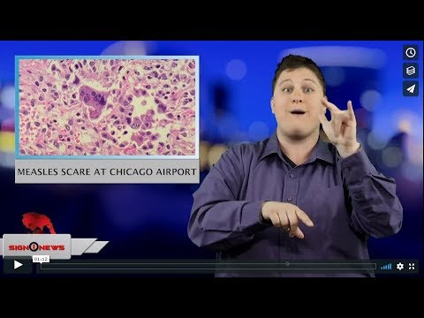 Measles scare at Chicago airport (ASL - 3.2.19)