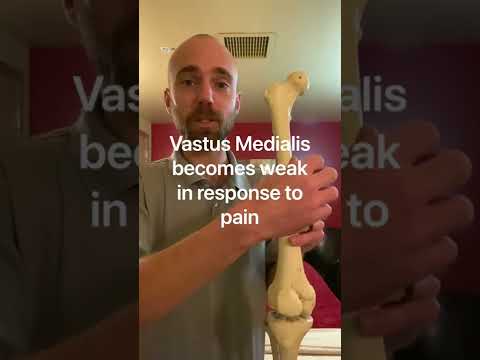 Talking about knee replacements