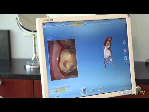 download lagu mp3 mp4 Cerec Ac, download lagu Cerec Ac gratis, unduh video klip Cerec Ac