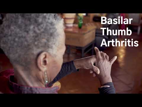 Basilar Thumb Arthritis and Arthroplasty