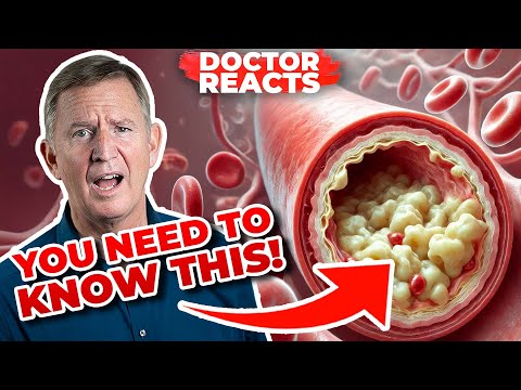 5 Myths About Your CAC Score You Need To Know! - Doctor Reacts