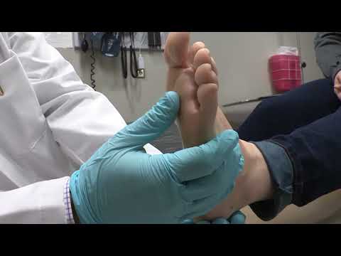 ASK UNMC! How can I tell if I have athlete's foot?