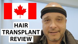 Hair Transplant Patient Review: Hello Canada! Elefterios's Hair Transplant Experience at AEK Hair Clinic