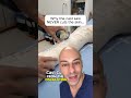 Why REMOVING a cast is the GREATEST feeling ever...