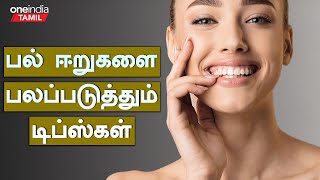 பல் ஈறுகளை பலப்படுத்தும் அற்புத டிப்ஸ்கள் | Mouth Gums Turning Black? Home Remedy in Tamil