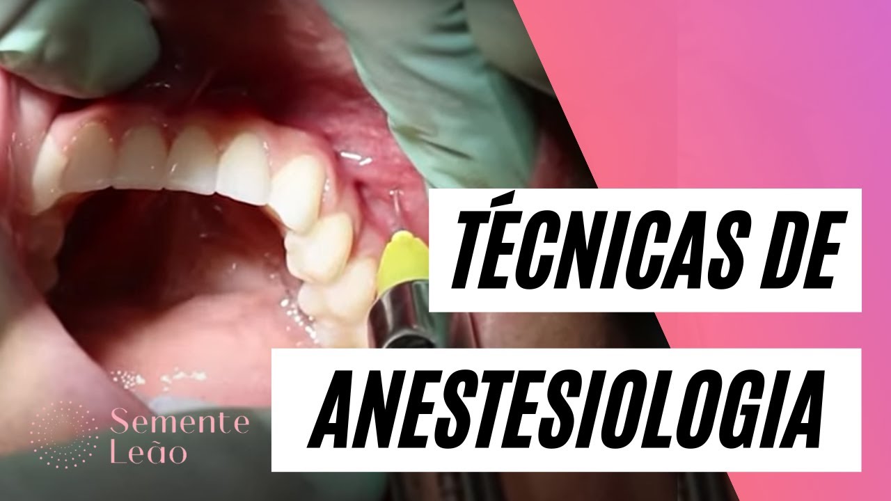 Técnicas de anestesiologia local, utilizadas na Odontologia | Semente Leão | Dra. Tuanny Lima
