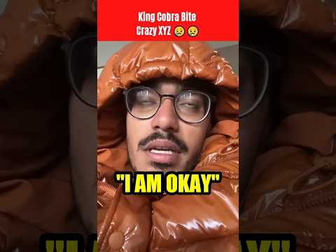 Cobra Snake Bites @CrazyXYZ Amit Bhai?? 🐍😰 #shorts #viral #shortsvideo