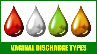 Vaginal Discharge Types – White Clear Watery Brown Bloody | Yellow and Green Discharge