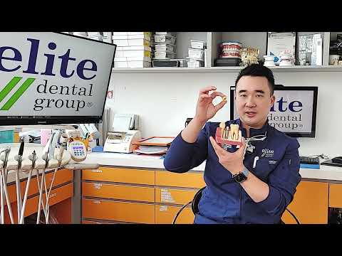 hqdefault | Elite Dental Group