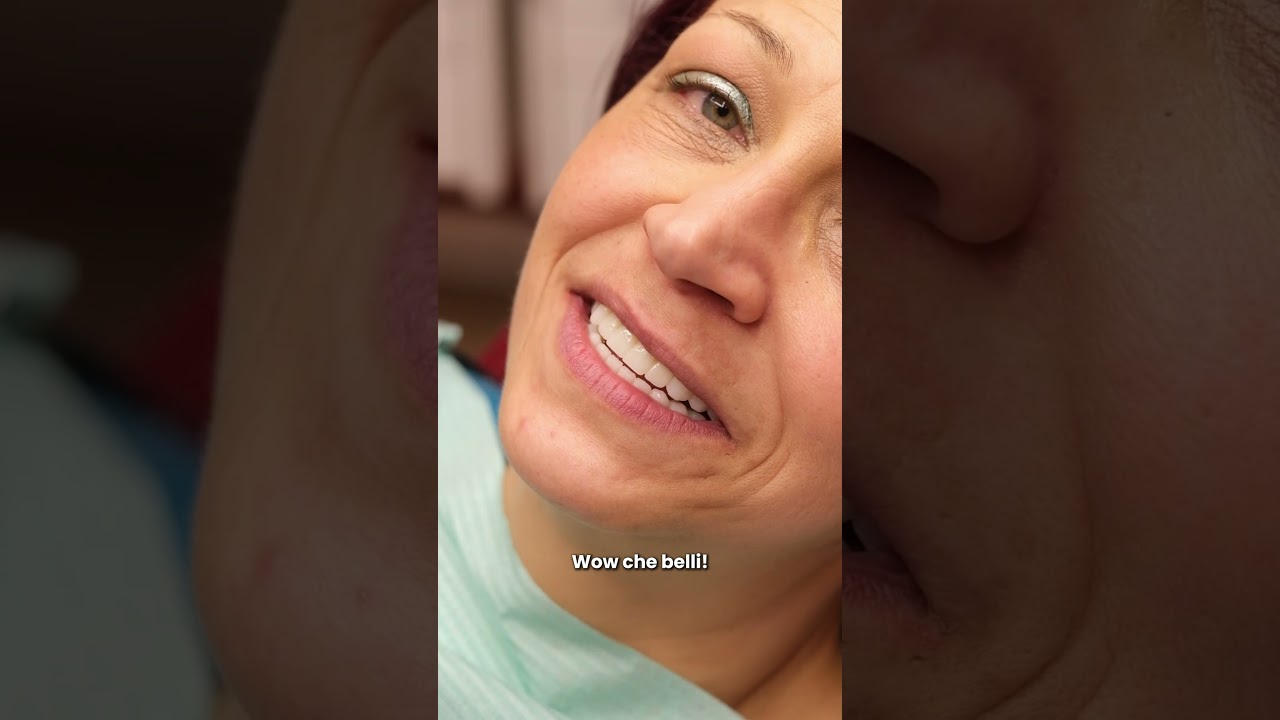 Un risultato WOW - Golden Dental