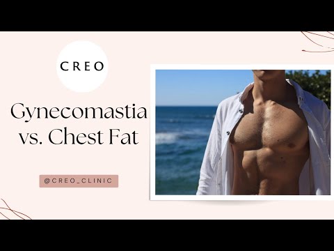 Is it Gynecomastia or Chest Fat? | Ask A Plastic Surgeon