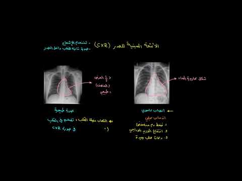 الصفوف المتقدمة الأحياء أمراض الجهاز الدوري تشخيص التهاب عضلة القلب والتهاب التامور الجزء 2