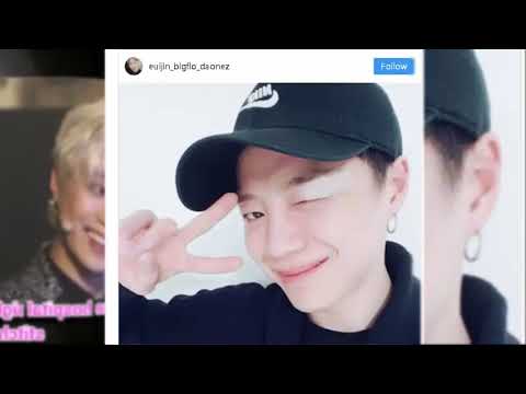 BIGFLO’s Euijin Gets 15 Stitches After Injuring Forehead During Practices