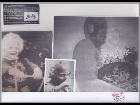 Physiologists can detect an abnormality in the gait. 