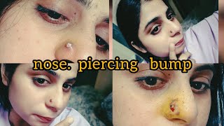 How to recover nose piercing bump 👃 100% profit