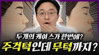 주걱턱과 무턱이 같이 있을 수 있다고요? 구분하는 법을 알려주세요!