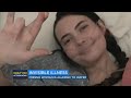Woman With Water Allergy Describes Living With Rare Condition
