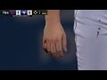 ALCS Gm3: Bauer leaves game with finger wound in 1st