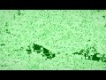 Tennis Round 1 Please Final Out Reason Crazy Ear Rape There Is Room For Two FUNNY