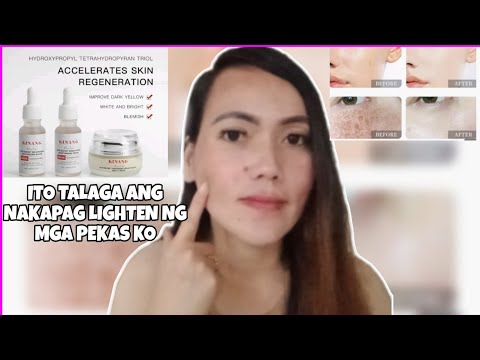 HOW TO LIGHTEN MY DARK SPOT OR PEKAS / KINANG SET WHITENING | momshie weng