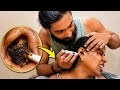 Deep Ear Cleaning So Satisfying Biggest Ear Wax Removal Ever Dirty Ear Cleaning ASMR