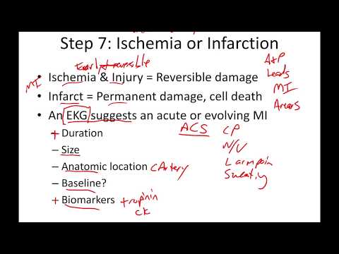 12-Lead EKG, Part 7: Myocardial Infarction, Repolarization, and Waveform Changes